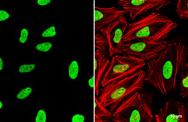 Anti-KAP1 antibody [N3C2], Internal used in Immunocytochemistry/ Immunofluorescence (ICC/IF). GTX102226