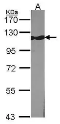 Anti-KAP1 antibody [N1N2], N-term used in Western Blot (WB). GTX102227