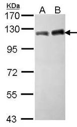 Anti-KAP1 antibody [N1N2], N-term used in Western Blot (WB). GTX102227