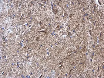 Anti-NDUFV2 antibody used in IHC (Paraffin sections) (IHC-P). GTX102259