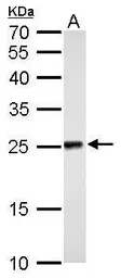 Anti-NDUFV2 antibody used in Western Blot (WB). GTX102259