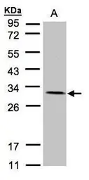 Anti-NDUFV2 antibody used in Western Blot (WB). GTX102259