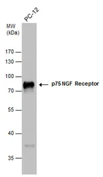 Anti-p75 NGF Receptor / CD271 antibody used in Western Blot (WB). GTX102262