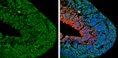 Anti-p75 NGF Receptor / CD271 antibody used in IHC (Frozen sections) (IHC-Fr). GTX102262