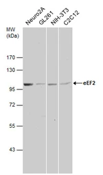 Anti-eEF2 antibody [N2C1], Internal used in Western Blot (WB). GTX102287