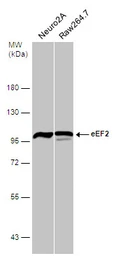 Anti-eEF2 antibody [N2C1], Internal used in Western Blot (WB). GTX102287