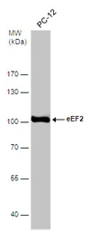 Anti-eEF2 antibody [N2C1], Internal used in Western Blot (WB). GTX102287