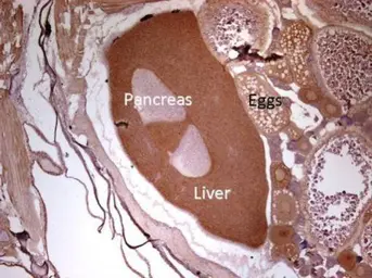 Anti-eEF2 antibody [N2C1], Internal used in IHC (Paraffin sections) (IHC-P). GTX102287