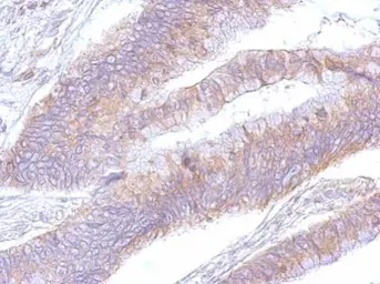 Anti-eEF2 antibody [N2C1], Internal used in IHC (Paraffin sections) (IHC-P). GTX102287