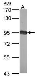 Anti-eEF2 antibody [N2C1], Internal used in Western Blot (WB). GTX102287