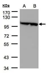 Anti-eEF2 antibody [N2C1], Internal used in Western Blot (WB). GTX102287