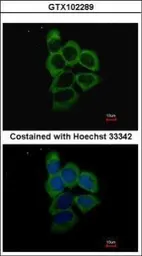 Anti-PSMD2 antibody used in Immunocytochemistry/ Immunofluorescence (ICC/IF). GTX102289