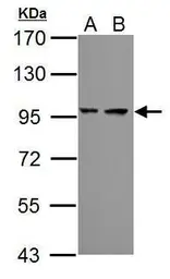 Anti-PSMD2 antibody used in Western Blot (WB). GTX102289