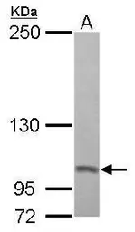 Anti-PSMD2 antibody used in Western Blot (WB). GTX102289