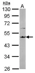 Anti-EEF1A2 antibody [C1C3] used in Western Blot (WB). GTX102327