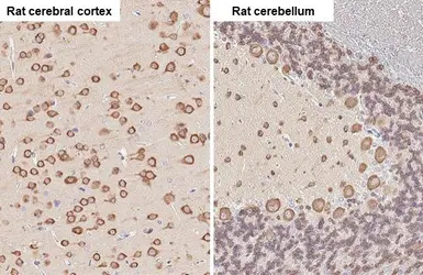 Anti-EEF1A2 antibody [C1C3] used in IHC (Paraffin sections) (IHC-P). GTX102327