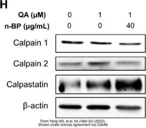 Anti-Calpain 1 antibody [N3C2], Internal used in Western Blot (WB). GTX102340