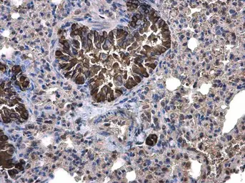 Anti-Calpain 1 antibody [N3C2], Internal used in IHC (Paraffin sections) (IHC-P). GTX102340