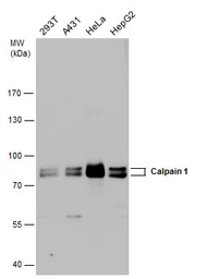 Anti-Calpain 1 antibody [N3C2], Internal used in Western Blot (WB). GTX102340