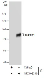 Anti-Calpain 1 antibody [N3C2], Internal used in Immunoprecipitation (IP). GTX102340