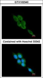 Anti-Calpain 1 antibody [N3C2], Internal used in Immunocytochemistry/ Immunofluorescence (ICC/IF). GTX102340