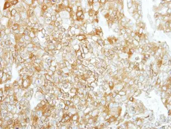 Anti-Calpain 1 antibody [N3C2], Internal used in IHC (Paraffin sections) (IHC-P). GTX102340