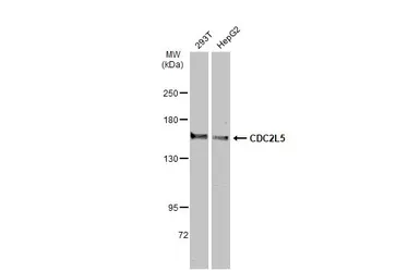 Anti-CDC2L5 antibody used in Western Blot (WB). GTX102408