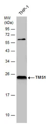 Anti-TMS1 antibody [N1C3] used in Western Blot (WB). GTX102474