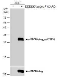 Anti-TMS1 antibody [N1C3] used in Western Blot (WB). GTX102474