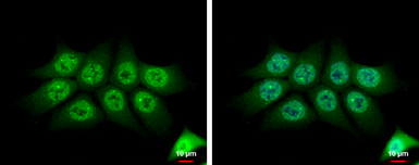 Anti-TMS1 antibody [N1C3] used in Immunocytochemistry/ Immunofluorescence (ICC/IF). GTX102474