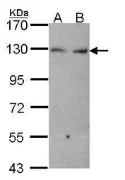 Anti-K-Cadherin antibody [N2C1], Internal used in Western Blot (WB). GTX102502