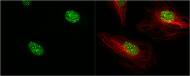 Anti-53BP1 antibody [N1], N-term used in Immunocytochemistry/ Immunofluorescence (ICC/IF). GTX102595