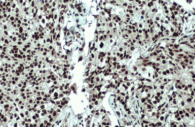 Anti-53BP1 antibody [N1], N-term used in IHC (Paraffin sections) (IHC-P). GTX102595