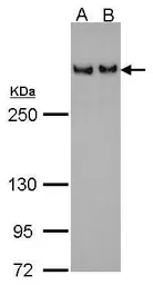 Anti-53BP1 antibody [N1], N-term used in Western Blot (WB). GTX102595