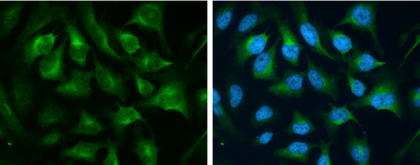 Anti-CD71 antibody [N2C1], Internal used in Immunocytochemistry/ Immunofluorescence (ICC/IF). GTX102596