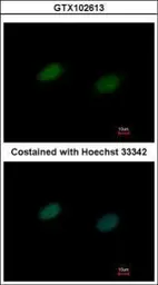 Anti-UBA2 antibody [N1N3] used in Immunocytochemistry/ Immunofluorescence (ICC/IF). GTX102613