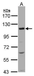 Anti-KCC4 antibody [C2C3], C-term used in Western Blot (WB). GTX102628