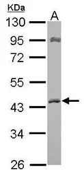 Anti-ACAT1 antibody [N1N3] used in Western Blot (WB). GTX102637