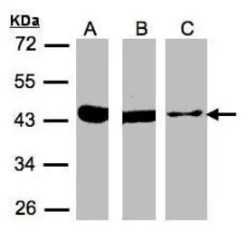 Anti-ACAT1 antibody [N1N3] used in Western Blot (WB). GTX102637