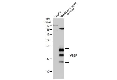 Anti-VEGFA antibody used in Western Blot (WB). GTX102643