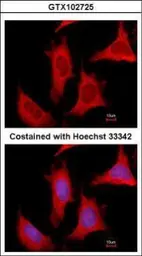 Anti-PPAT antibody used in Immunocytochemistry/ Immunofluorescence (ICC/IF). GTX102725