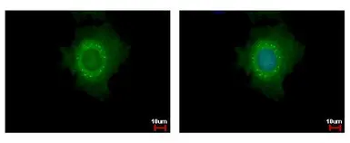 Anti-DDX6 antibody used in Immunocytochemistry/ Immunofluorescence (ICC/IF). GTX102795