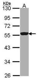 Anti-DDX6 antibody used in Western Blot (WB). GTX102795