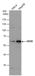 Anti-ARSB antibody [N3C3] used in Western Blot (WB). GTX102829