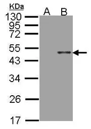 Anti-ARSB antibody [N3C3] used in Western Blot (WB). GTX102829