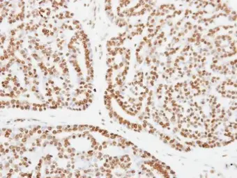 Anti-XPC antibody [C2C3], C-term used in IHC (Paraffin sections) (IHC-P). GTX102840