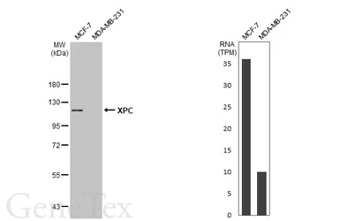 Anti-XPC antibody [C2C3], C-term used in Western Blot (WB). GTX102840