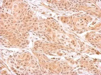 Anti-ZNF134 antibody used in IHC (Paraffin sections) (IHC-P). GTX102844