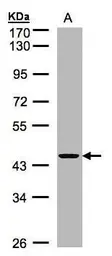 Anti-ZNF134 antibody used in Western Blot (WB). GTX102844