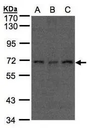 Anti-Apc6 antibody [C1C3] used in Western Blot (WB). GTX102905